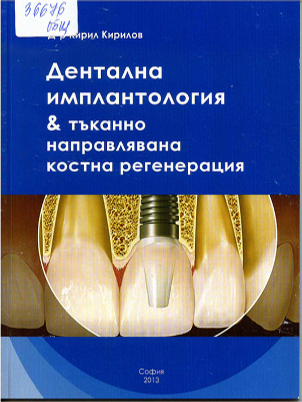 Дентална имплантология и тъканно направлявана костна регенерация