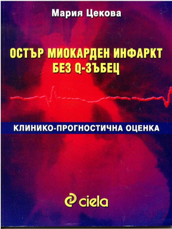 Остър миокарден инфаркт без Q-зъбец