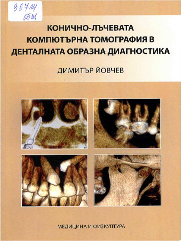 Конично-лъчевата компютърна томография в денталната образна диагностика