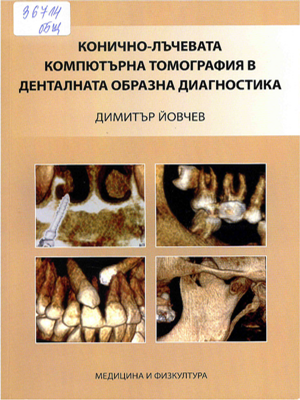 Конично-лъчевата компютърна томография в денталната образна диагностика