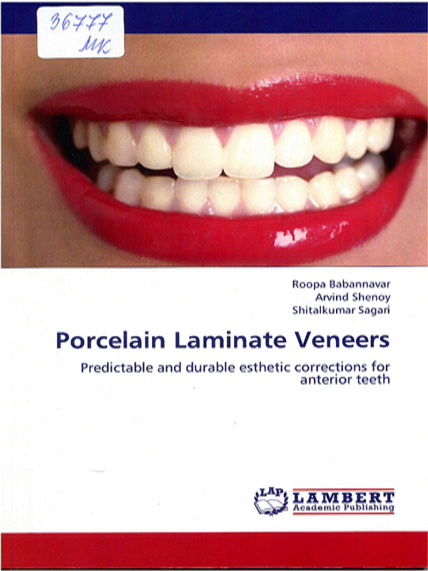 Porcelain laminate veneers