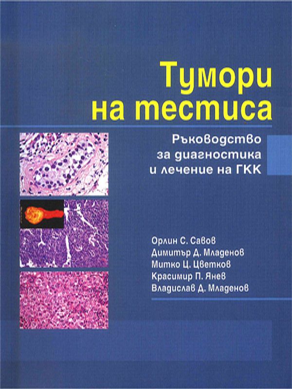 Тумори на тестиса