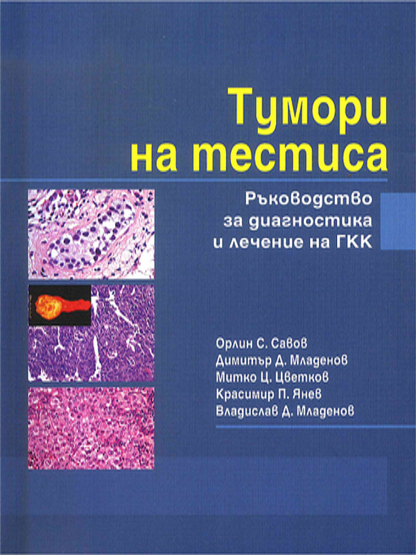 Тумори на тестиса