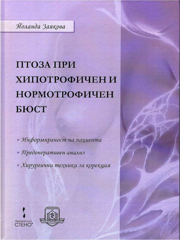 Птоза при хипотрофичен и нормотрофичен бюст