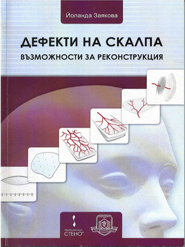 Дефекти на скалпа - възможности за реконструкция