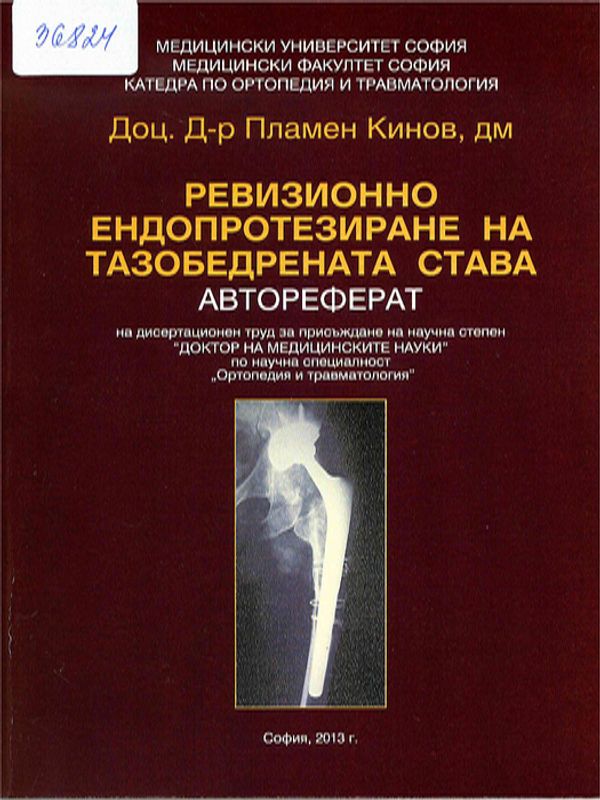 Ревизионно ендопротезиране на тазобедрената става