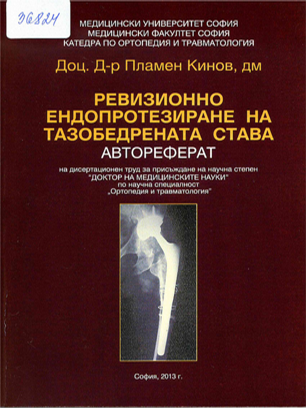 Ревизионно ендопротезиране на тазобедрената става