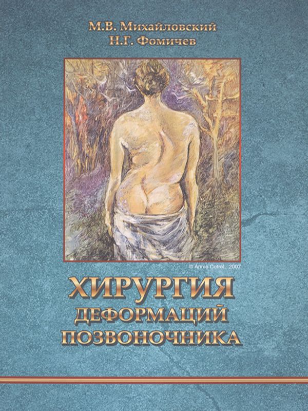 Хирургия деформаций позвоночника