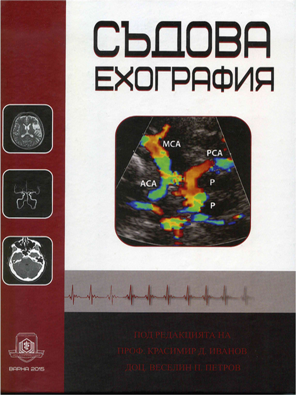 Съдова ехография