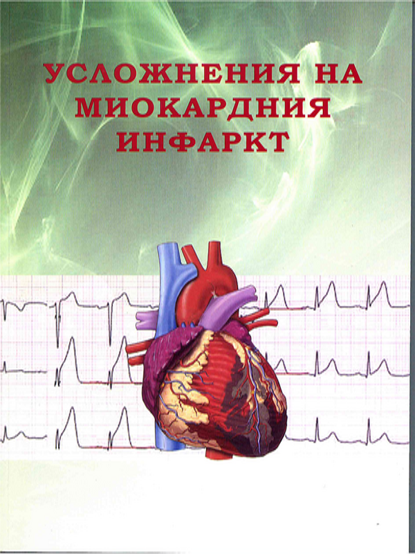 Усложнения на миокардния инфаркт