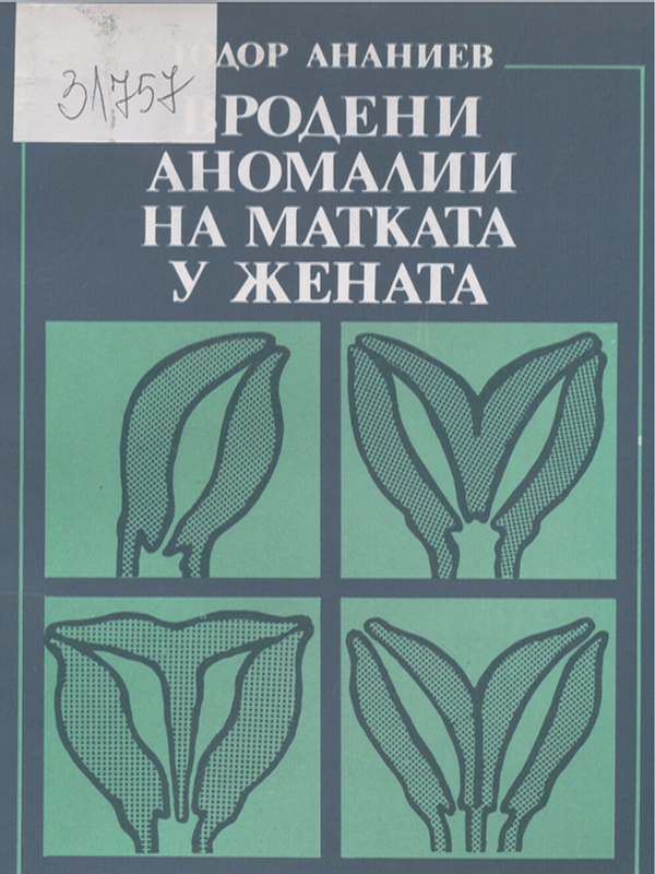 Вродени аномалии на матката у жената