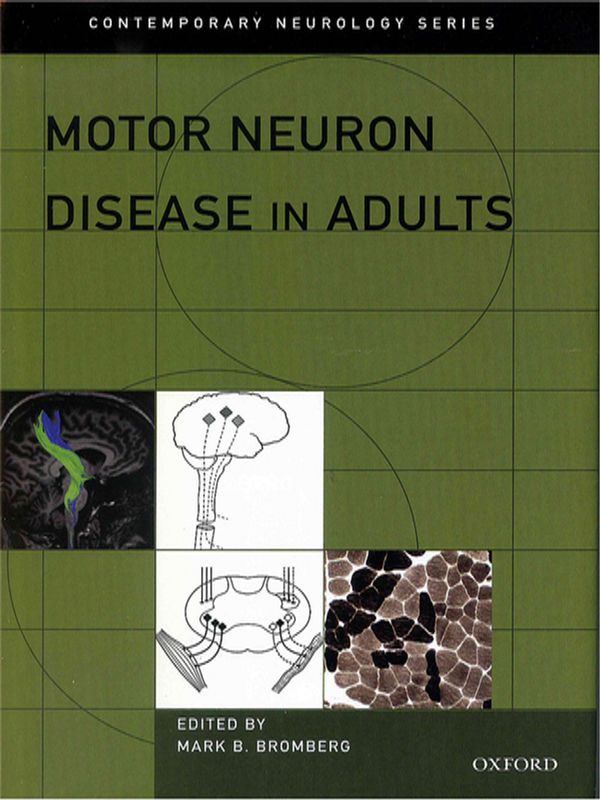 Motor neuron disease in adults