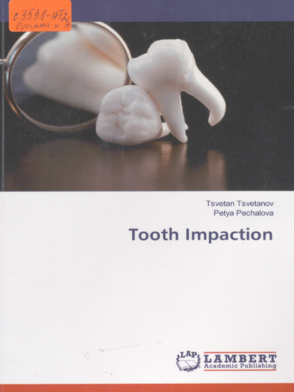 Tooth impaction