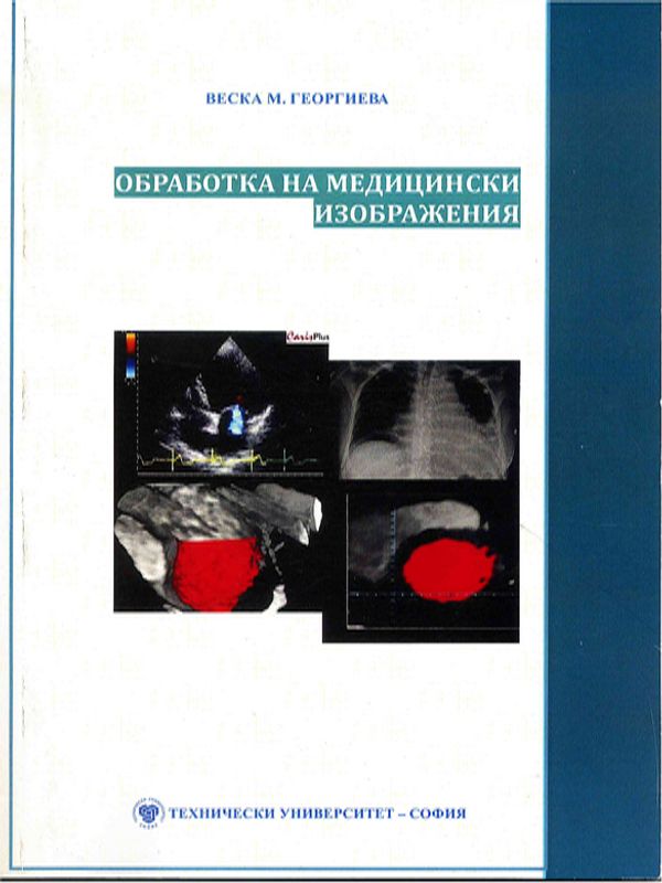 Обработка на медицински изображения
