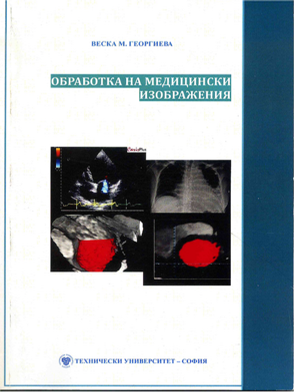 Обработка на медицински изображения