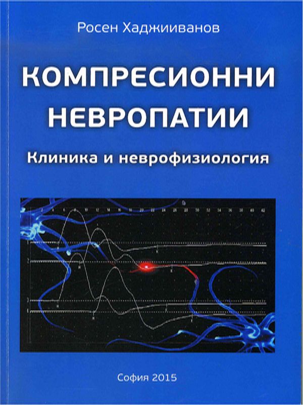 Компресионни невропатии