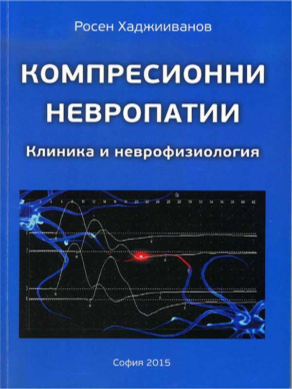 Компресионни невропатии