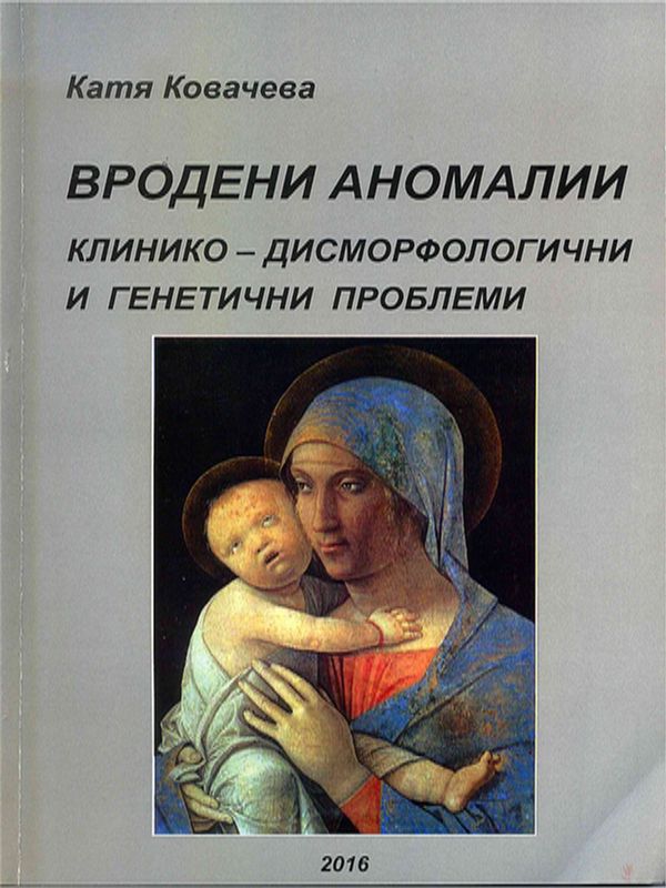 Вродени аномалии