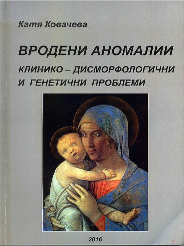 Вродени аномалии