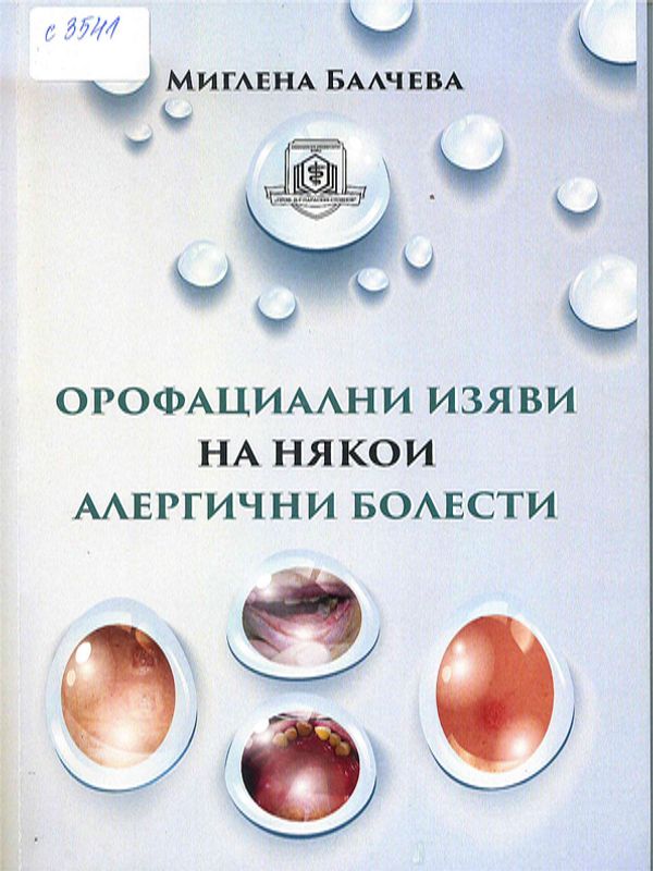Орофациални изяви на някои алергични болести
