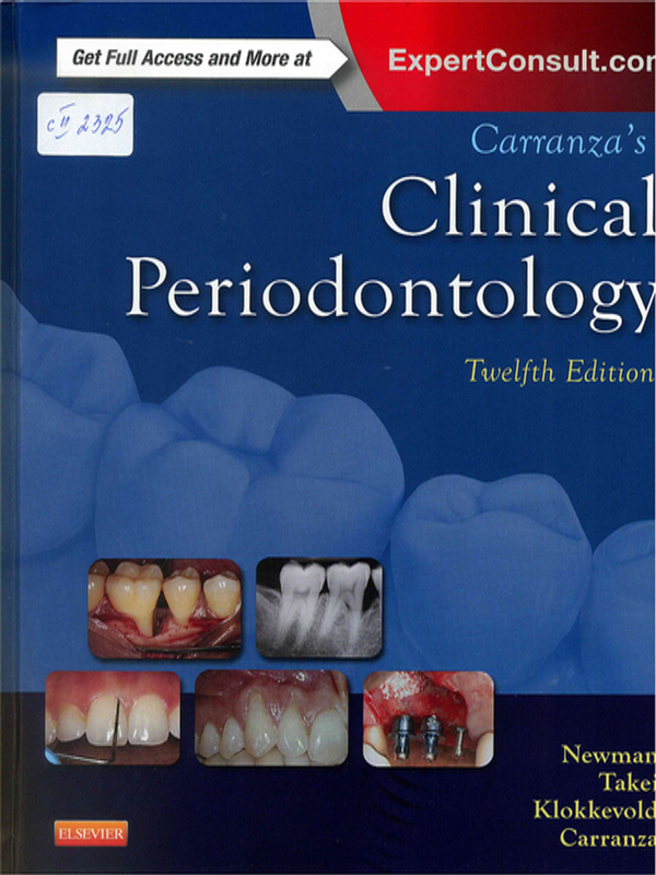 Carranza`s clinical periodontology