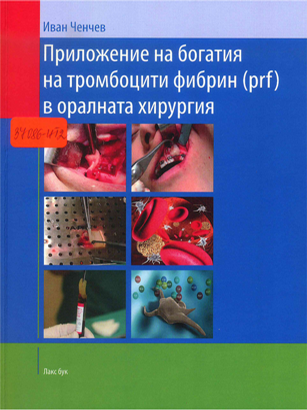 Приложение на богатия на тромбоцити фибрин (prf) в оралната хирургия