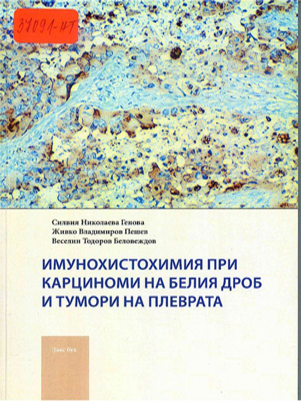 Имунохистохимия при карциноми на белия дроб и тумори на плеврата