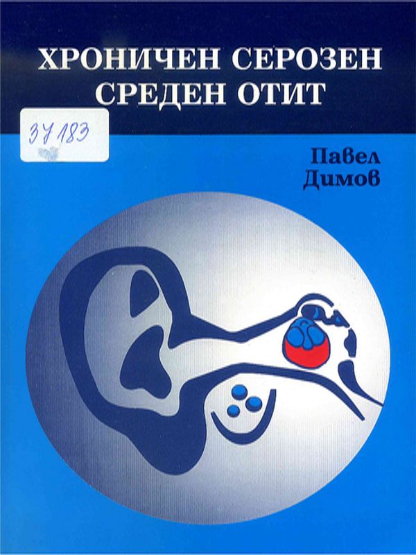 Хроничен серозен среден отит