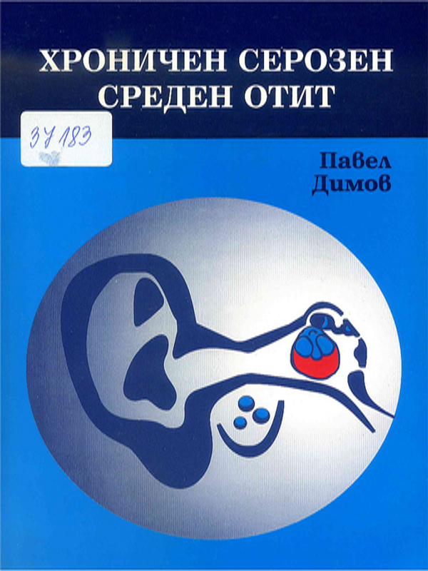 Хроничен серозен среден отит