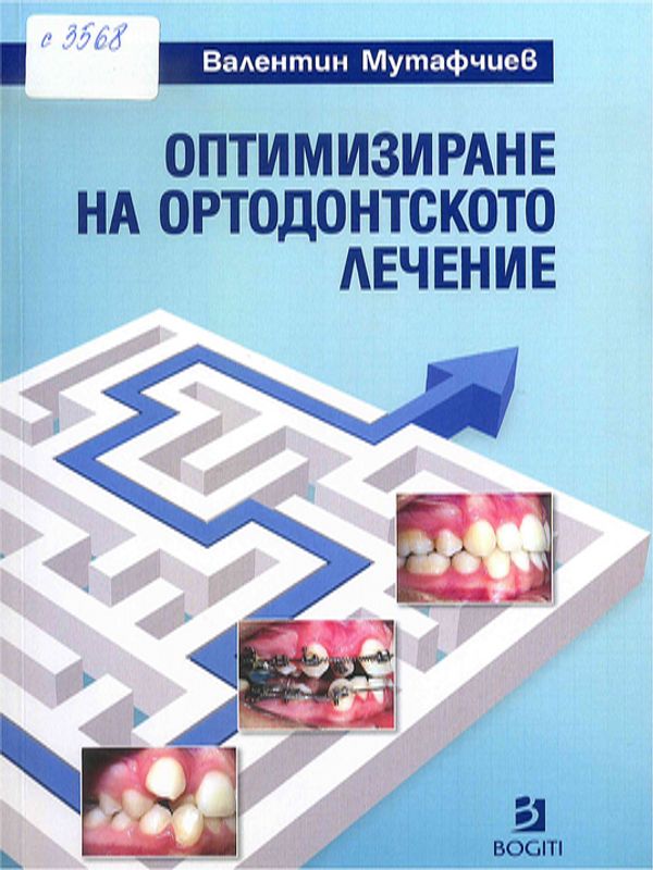 Оптимизиране на ортодонтското лечение
