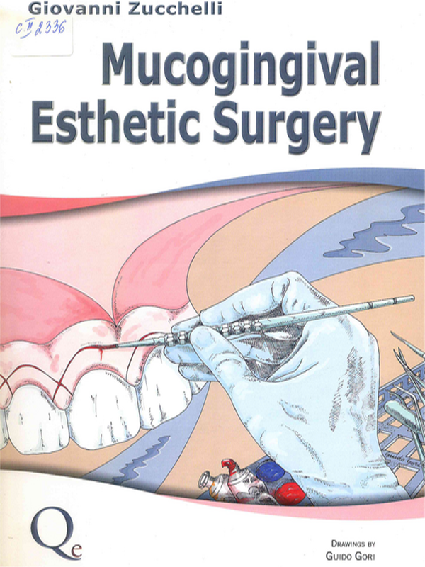 Mucogingival esthetic surgery