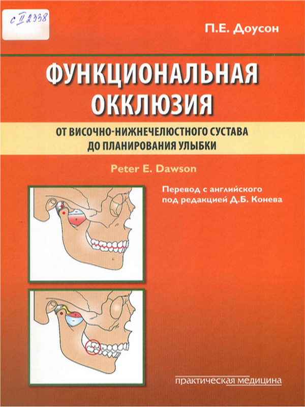 Функциональная окклюзия