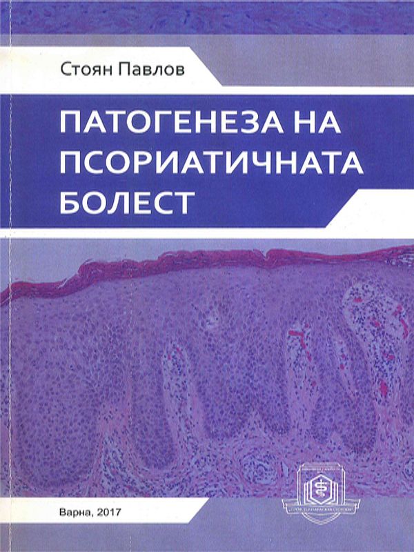 Патогенеза на псориатичната болест