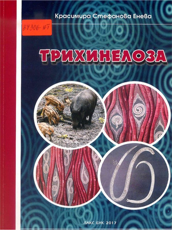 Трихинелоза