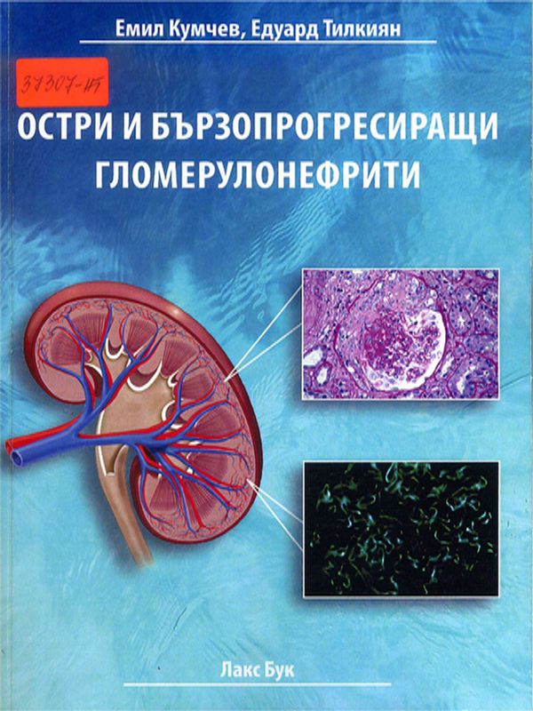 Остри и бързопрогресиращи гломерулонефрити