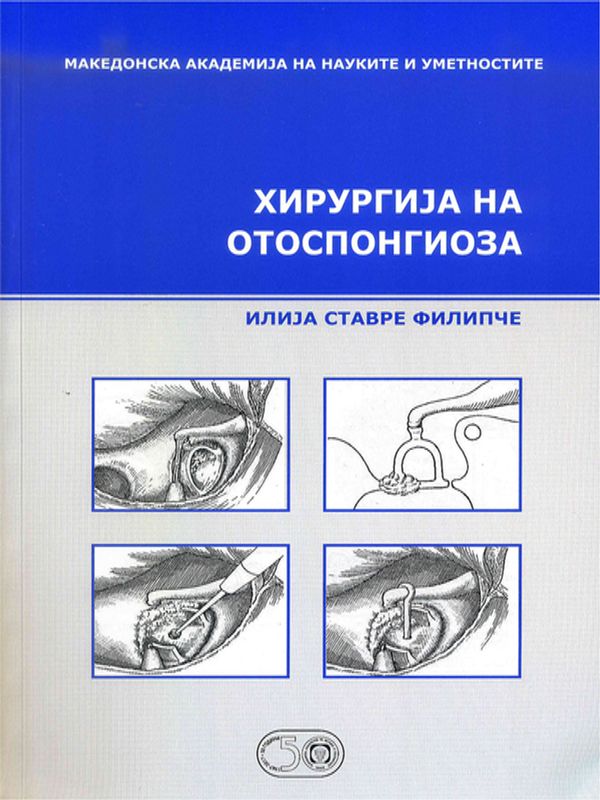 Хирургиjа на отоспонгиоза