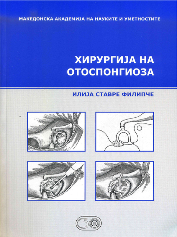 Хирургиjа на отоспонгиоза