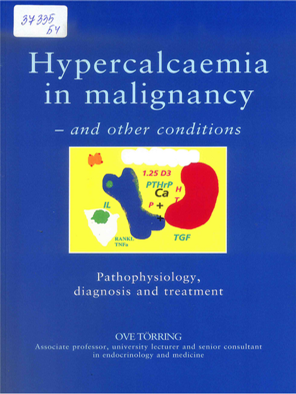Hipercalcaemia in malignancy - and other conditions