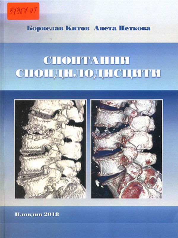Спонтанни спондилодисцити