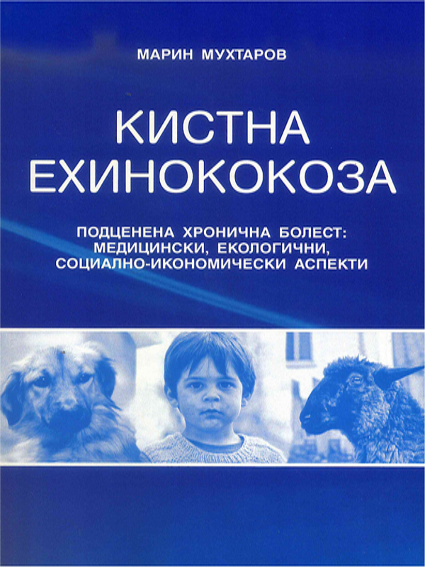 Кистна ехинококоза