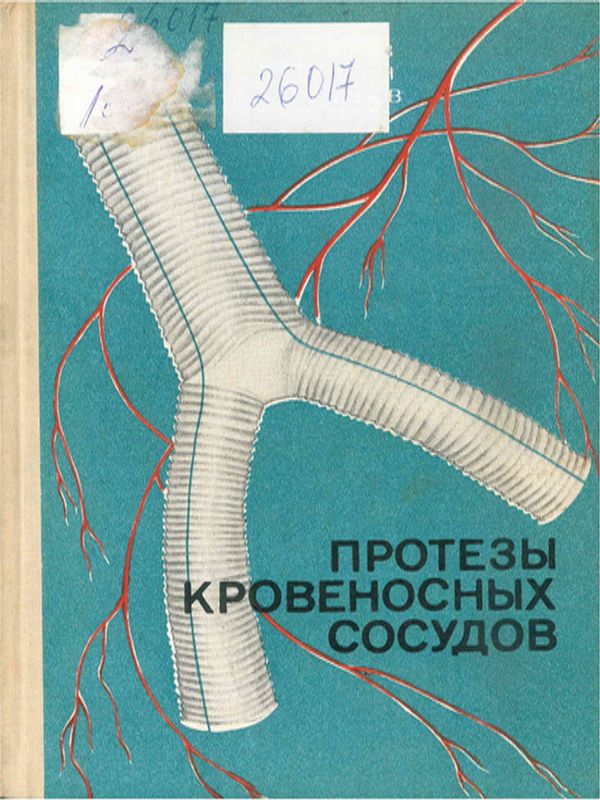 Протезы кровеносных сосудов