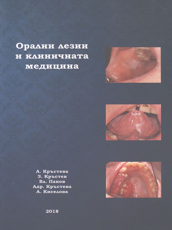 Орални лезии и клиничната медицина