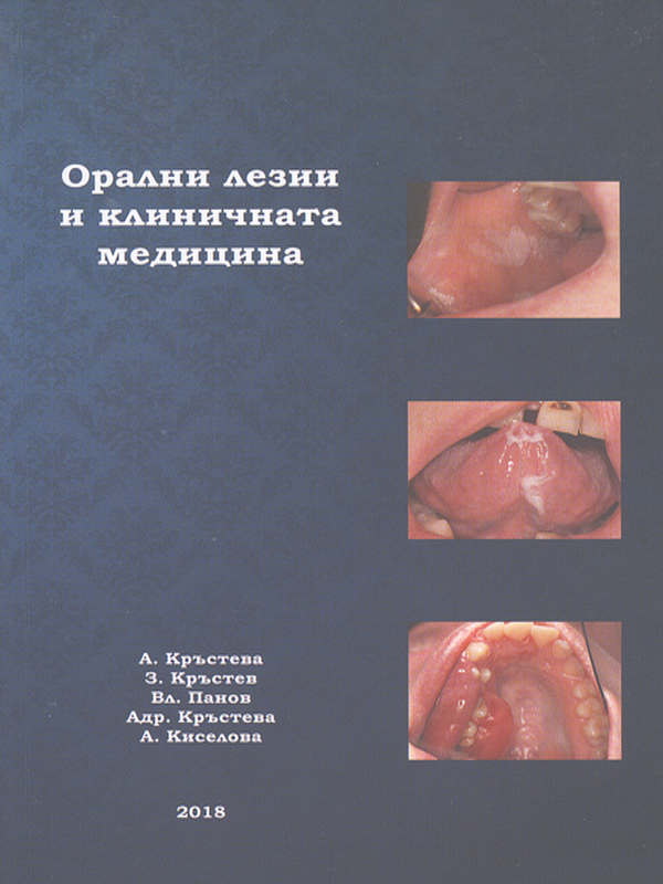 Орални лезии и клиничната медицина