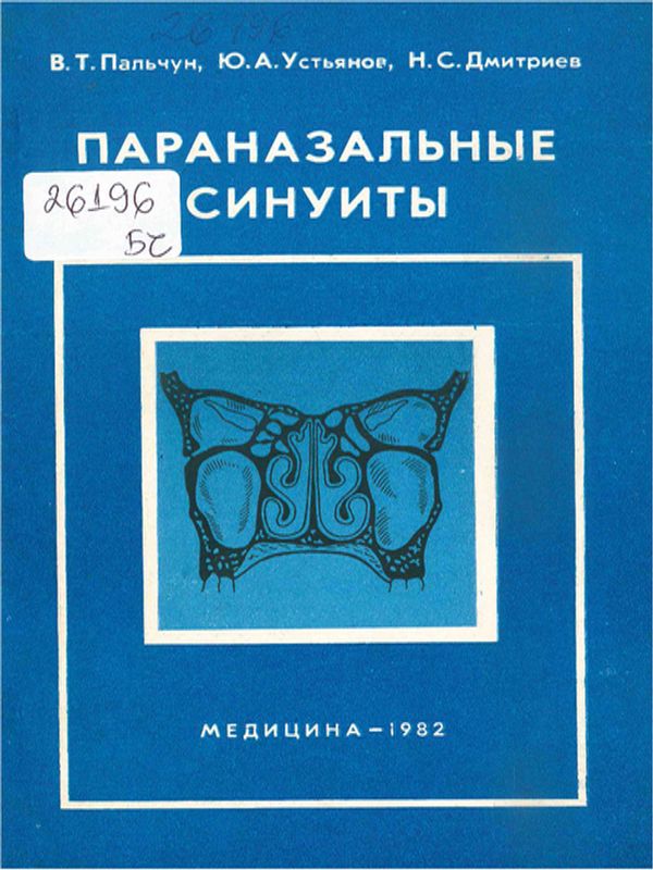 Параназальные синуиты