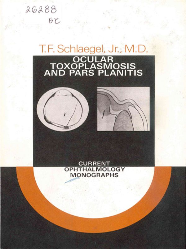 Ocular toxoplasmosis and pars planitis