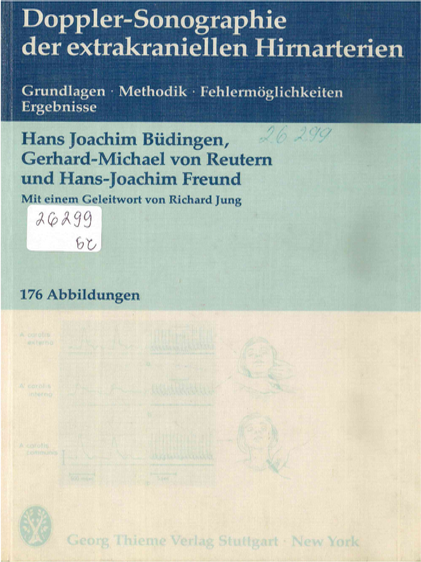 Doppler-Sonographie der extrakraniellen Hirnarterien