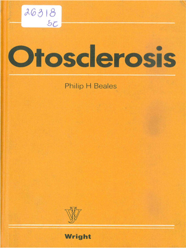 Otosclerosis