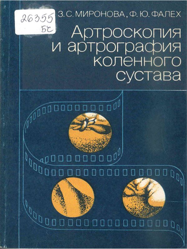 Артроскопия и артрография коленного сустава