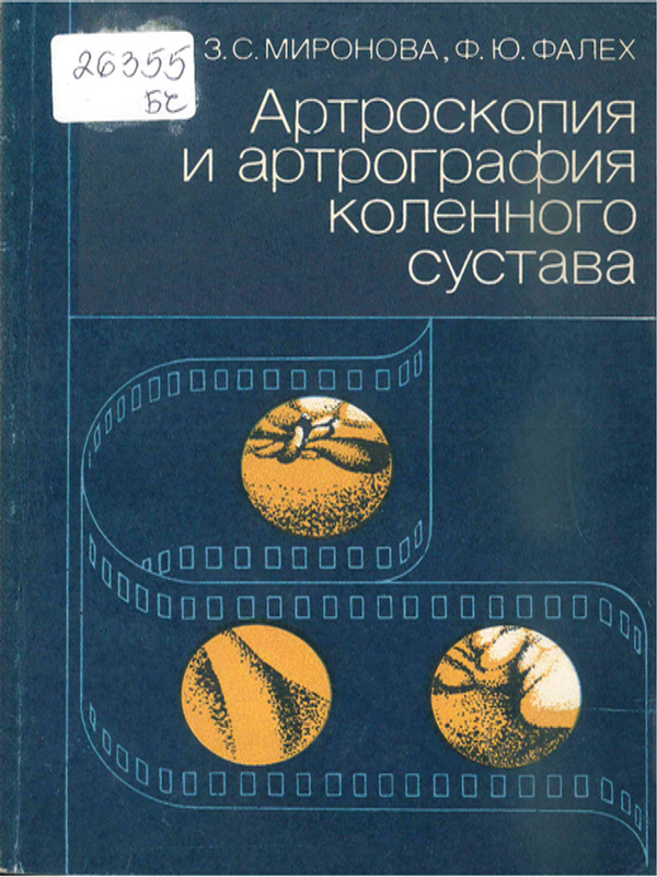 Артроскопия и артрография коленного сустава
