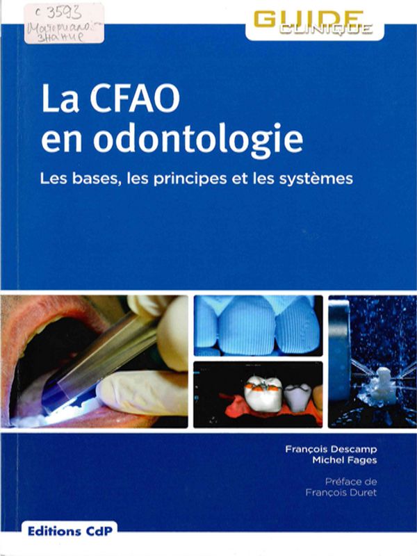 La CFAO en odontologie